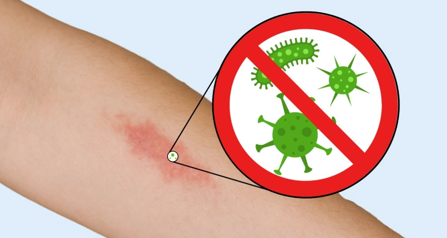 Menschenbisse am Arbeitsplatz: Die versteckten Gefahren - und wie Sie sich schützen