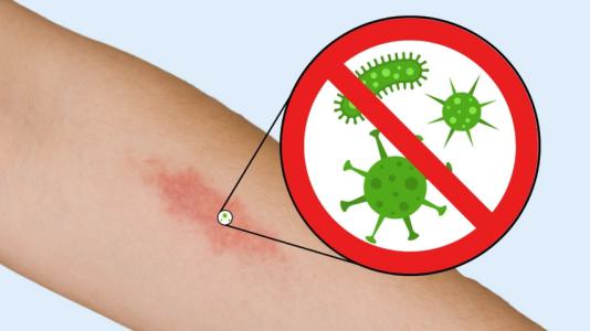 Menschenbisse am Arbeitsplatz: Die versteckten Gefahren - und wie Sie sich schützen